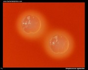 beta hemolysis on blood agar